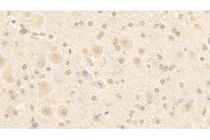 Detection of NUP133 in Mouse Cerebellum Tissue using Polyclonal Antibody to Nucleoporin 133 (NUP133) (NUP133 Antikörper  (AA 36-240))