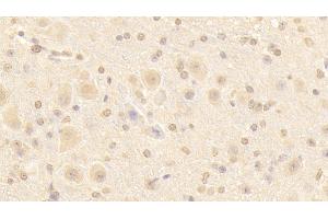 Detection of NUP133 in Mouse Cerebellum Tissue using Polyclonal Antibody to Nucleoporin 133 (NUP133)