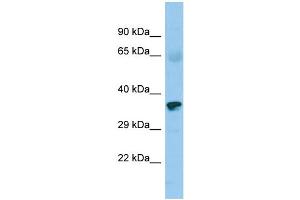 Host: Rabbit Target Name: ZNF330 Sample Type: Fetal Heart lysates Antibody Dilution: 1. (ZNF330 Antikörper  (C-Term))