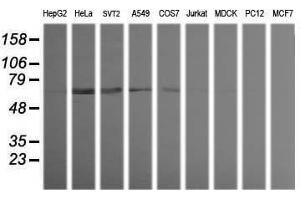 Image no. 2 for anti-Tripartite Motif Containing 38 (TRIM38) (AA 1-265) antibody (ABIN1490688) (TRIM38 Antikörper  (AA 1-265))