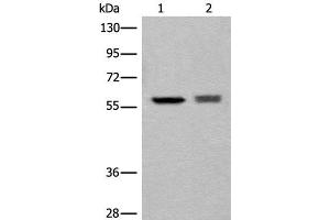 Western blot analysis of EPG2 and Jurkat cell lysates using ATL3 Polyclonal Antibody at dilution of 1:800 (ATL3 Antikörper)