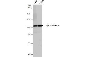 WB Image alpha Actinin 2 antibody detects alpha Actinin 2 protein by western blot analysis.