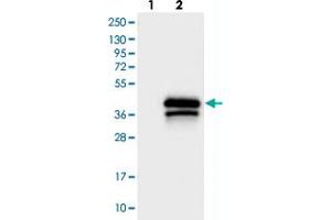 Western blot analysis of Lane 1: Negative control (vector only transfected HEK293T lysate), Lane 2: Over-expression Lysate (Co-expressed with a C-terminal myc-DDK tag (~3. (TREML1 Antikörper)