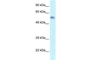 WB Suggested Anti-Zfp472 Antibody   Titration: 1. (Zfp472 Antikörper  (N-Term))