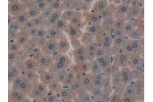 Detection of CYR61 in Mouse Liver Tissue using Polyclonal Antibody to Cysteine Rich Protein, Angiogenic Inducer 61 (CYR61) (CYR61 Antikörper  (AA 176-379))
