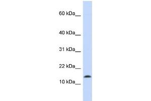 WB Suggested Anti-SNCA Antibody Titration:  0. (SNCA Antikörper  (Middle Region))