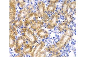 Immunohistochemistry of paraffin-embedded Rat kidney using RPN1 Polyclonal Antibody at dilution of 1:100 (40x lens). (RPN1 Antikörper)