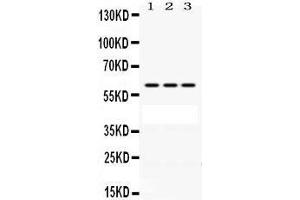 Western Blotting (WB) image for anti-Protection of Telomeres 1 (POT1) (AA 195-234), (N-Term) antibody (ABIN3043444) (POT1 Antikörper  (N-Term))