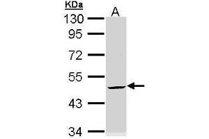 KRT20 Antikörper