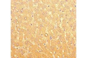Immunohistochemistry of paraffin-embedded human liver tissue using ABIN7166656 at dilution of 1:100 (LPAL2 Antikörper  (AA 52-124))