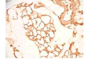 Mouse visceral fat tissue was stained by Rabbit Anti-SFRP-2 S (25-50) (Human) Antiserum (SFRP2 Antikörper  (AA 25-50))