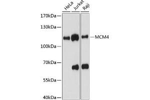 Western blot analysis of extracts of various cell lines, using MCM4 antibody (ABIN6134153, ABIN6143642, ABIN6143643 and ABIN6217540) at 1:1000 dilution. (MCM4 Antikörper  (AA 350-450))