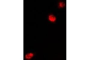 Immunofluorescent analysis of MeCP2 staining in U2OS cells. (MECP2 Antikörper)