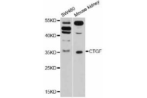 Western blot analysis of extracts of various cell lines, using CTGF antibody (ABIN5997530) at 1/1000 dilution. (CTGF Antikörper)