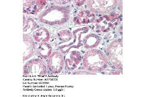 Immunohistochemistry with Human kidney lysate tissue at an antibody concentration of 5. (TRIM68 Antikörper  (Middle Region))