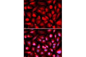 Immunofluorescence analysis of U2OS cells using ETS1 antibody (ABIN6293299).