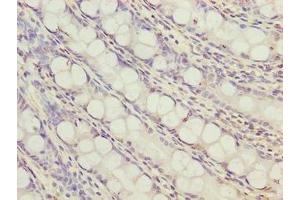 Immunohistochemistry of paraffin-embedded human colon tissue using ABIN7166380 at dilution of 1:100 (ZNF767P Antikörper  (AA 1-118))