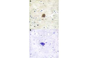 Immunohistochemical staining (Formalin-fixed paraffin-embedded sections) of human brain tissue with CAMK2A/CAMK2B/CAMK2D (phospho T305) polyclonal antibody  without blocking peptide (A) or preincubated with blocking peptide (B) under 1:50-1:100 dilution. (CAMK2A Antikörper  (pThr305))