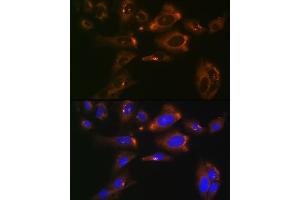 Immunofluorescence analysis of U-2 OS cells using ACLY Rabbit mAb (ABIN1678575, ABIN7101559, ABIN7101560 and ABIN7101561) at dilution of 1:100 (40x lens). (ACLY Antikörper)