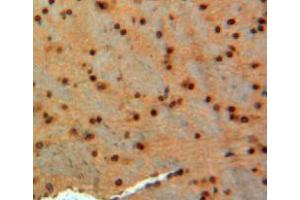 IHC-P analysis of brain tissue, with DAB staining. (GAD Antikörper  (AA 1-97))