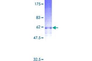 GPR17 Protein (AA 1-339) (GST tag)