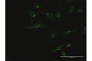 Immunofluorescence (IF) image for anti-UDP-Gal:betaGal beta 1,3-Galactosyltransferase Polypeptide 6 (B3GALT6) (AA 1-329) antibody (ABIN1327437)