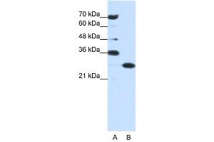 WB Suggested Anti-ANP32A  Antibody Titration: 0. (PHAP1 Antikörper  (Middle Region))