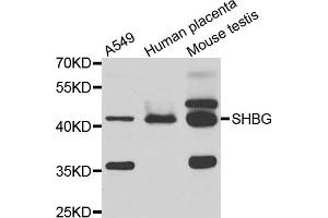Western blot analysis of extracts of various cell lines, using SHBG antibody (ABIN5975291) at 1/1000 dilution. (SHBG Antikörper)