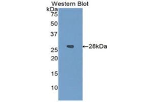 Western Blotting (WB) image for anti-Insulin-Like Growth Factor Binding Protein 4 (IGFBP4) (AA 22-258) antibody (ABIN3201236) (IGFBP4 Antikörper  (AA 22-258))