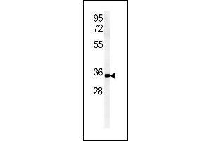 ZDHC2 Antibody (N-term) (ABIN651781 and ABIN2840397) western blot analysis in mouse Neuro-2a cell line lysates (15 μg/lane). (ZDHHC2 Antikörper  (AA 77-106))