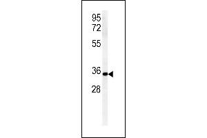 ZDHHC2 Antikörper  (AA 77-106)