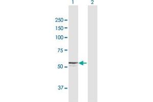 Western Blotting (WB) image for anti-Cytochrome P450, Family 27, Subfamily A, Polypeptide 1 (CYP27A1) (AA 1-531) antibody (ABIN947778)