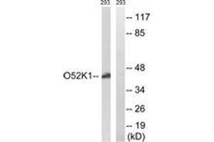 Western blot analysis of extracts from 293 cells, using OR52K1 Antibody. (OR52K1 Antikörper  (AA 201-250))