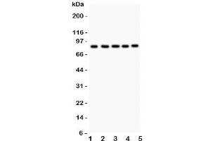 Western blot testing of FOXM1 antibody and Lane 1:  HeLa;  2: COLO320;  3: SW620;  4: SKOV;  5: MCD-7.