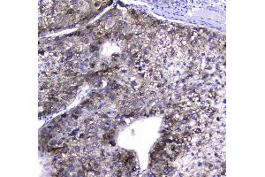 IHC analysis of HGD using anti-HGD antibody . (HGD Antikörper  (AA 374-445))