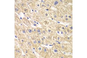Immunohistochemistry of paraffin-embedded human liver injury using ACADS antibody (ABIN5970342) at dilution of 1/100 (40x lens). (ACADS Antikörper)