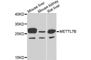 Western blot analysis of extracts of various cell lines, using METTL7B antibody (ABIN5974333) at 1/1000 dilution. (METTL7B Antikörper)