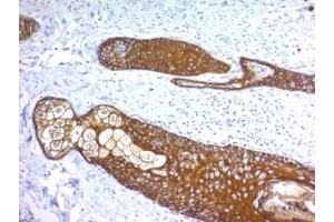 Formalin paraffin human skin stained with Basic Cytokeratin antibody (KRTH/1076). (Keratin Basic Antikörper)