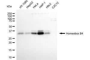Western blotting analysis using homeobox B4 antibody (ABIN7798992). (Rekombinanter HOXB4 Antikörper)