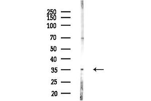 anti-Mitochondrial Ribosomal Protein L19 (MRPL19) (Internal Region) antibody