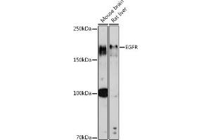 Western blot analysis of extracts of various cell lines, using EGFR antibody (ABIN7266982) at 1:1000 dilution. (EGFR Antikörper  (AA 1021-1210))