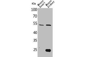 Western Blot analysis of mouse heart mouse kidney cells using Sg III Polyclonal Antibody (SCG3 Antikörper  (N-Term))