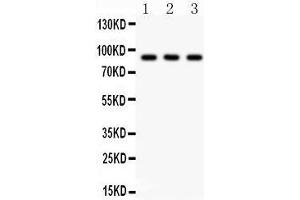 Anti-CTCF Picoband antibody, Western blotting All lanes: Anti CTCF  at 0. (CTCF Antikörper  (AA 521-727))