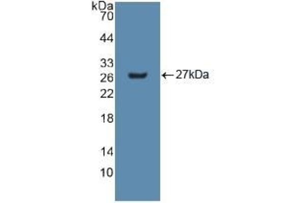 GSTM2 Antikörper  (AA 3-218)