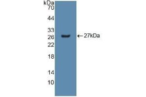 Detection of Recombinant GSTm2, Human using Polyclonal Antibody to Glutathione S Transferase Mu 2 (GSTM2) (GSTM2 Antikörper  (AA 3-218))