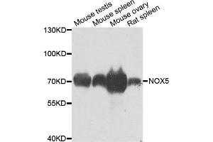 Western blot analysis of extracts of various cell lines, using NOX5 antibody. (NOX5 Antikörper)