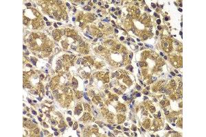 Immunohistochemistry of paraffin-embedded Human gastric using HSPE1 Polyclonal Antibody at dilution of 1:100 (40x lens). (HSPE1 Antikörper)
