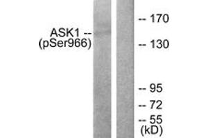 Western blot analysis of extracts from 293 cells treated with TNF(20ng/ml)+calyculinA(50nM) 15', using ASK1 (Phospho-Ser966) Antibody. (ASK1 Antikörper  (pSer966))