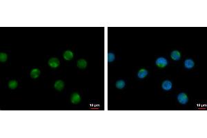 ICC/IF Image RPL17P7 antibody detects RPL17P7 protein at cytoplasm by immunofluorescent analysis. (RPL17P7 Antikörper  (Center))
