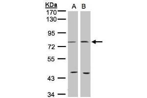 WB Image Sample(30 ug whole cell lysate) A:293T B:MOLT4 , 7. (PTGS2 Antikörper  (C-Term))